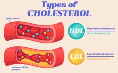 Cholesterol podcast