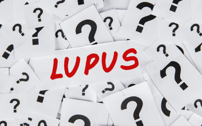 What is lupus? Symptoms and natural remedies