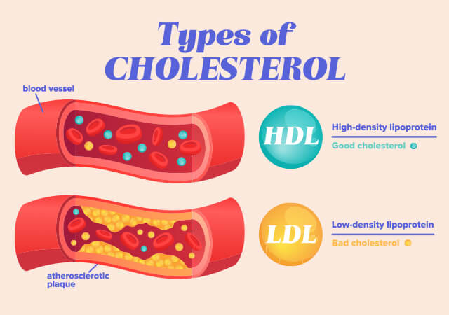 Types of Cholesterol