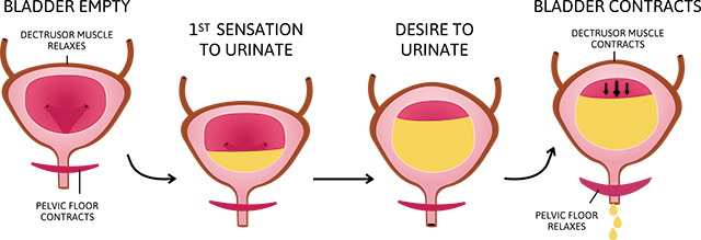 What are the signs and symptoms of interstitial cystitis