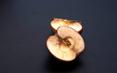 Oxidative stress: The silent culprit behind chronic disease