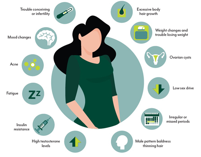 PMOS - Polyendocrine Metabolic Ovarian Syndrome